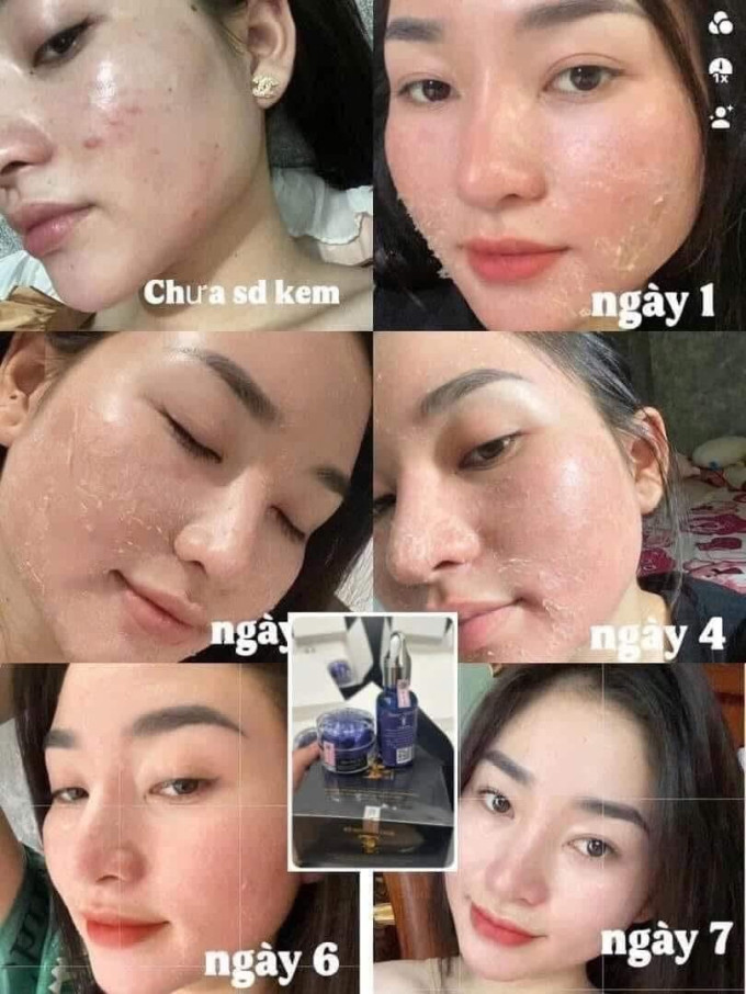 Tái tạo và phục hồi làn da hư tổn, giúp da khỏe mạnh hơn mỗi ngày.