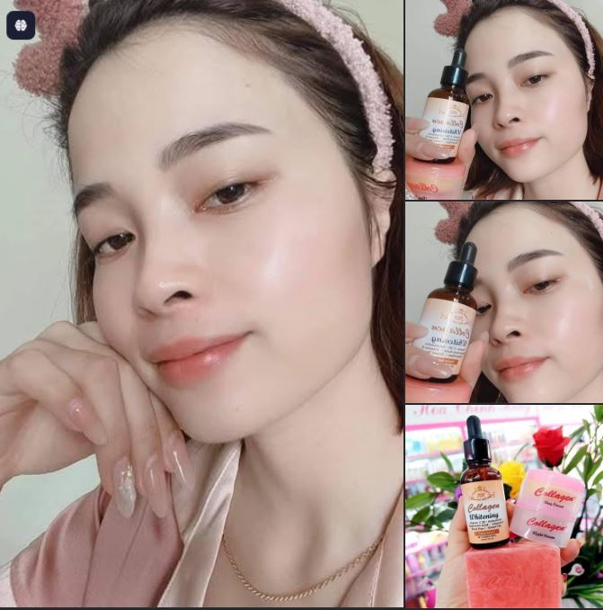 Giải pháp cải thiện da nám tại nhà