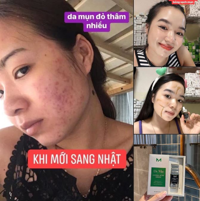 Đối tượng sử dụng Dr Mai