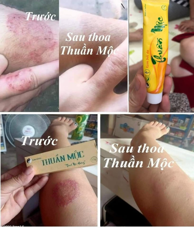 Rất phù hợp cho trẻ nhỏ và người lớn có da nhạy cảm