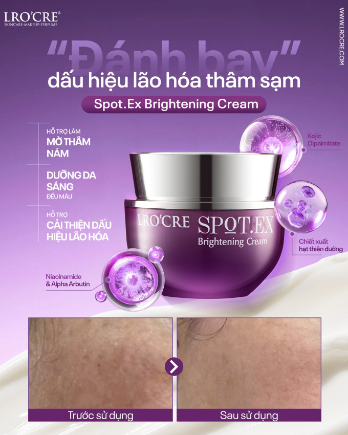 Kem Nám Spot Lrocre – Hỗ Trợ Mờ Nám, Tàn Nhang Và Dưỡng Sáng Da