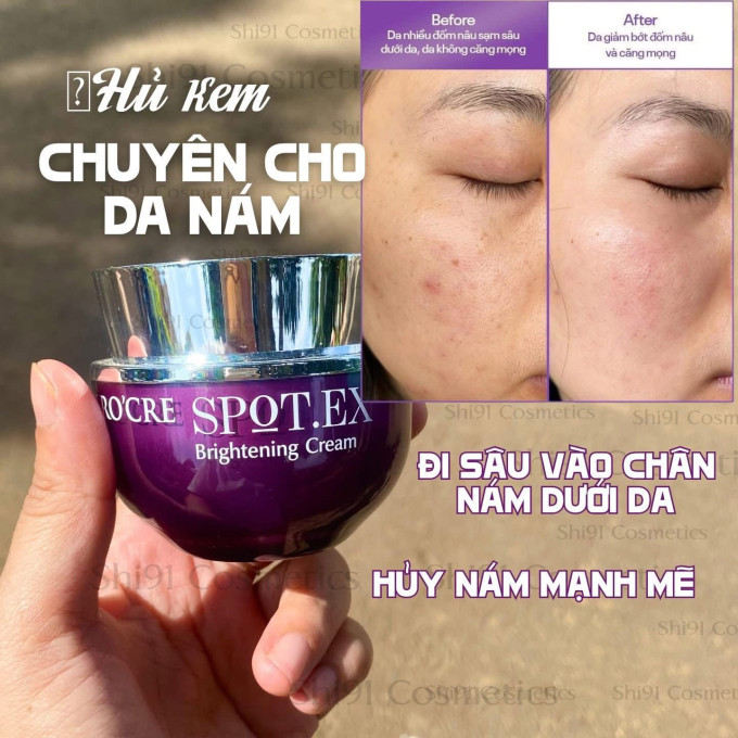 Kem Nám Spot Lrocre – Hỗ Trợ Mờ Nám, Tàn Nhang Và Dưỡng Sáng Da