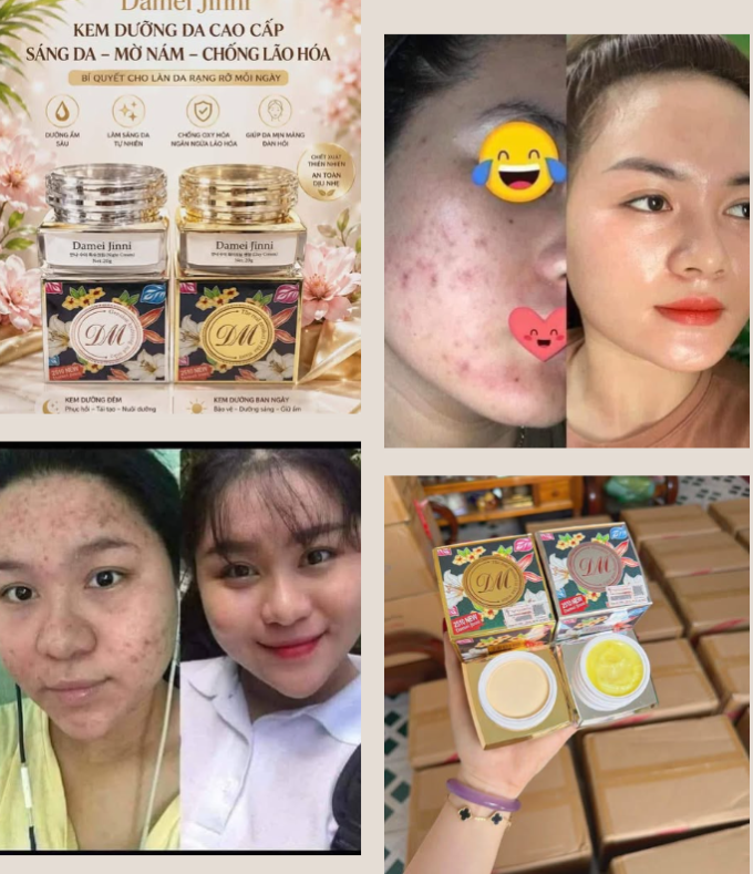 Khách Hàng Chia Sẻ Trải Nghiệm Sử Dụng Damei Jinni