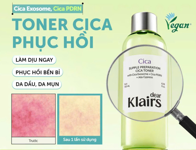 Nước hoa hồng Dear Klairs Cica Toner phù hợp với ai