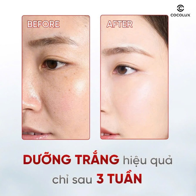Điểm nổi bật của Kem Dưỡng Trắng Melasma X